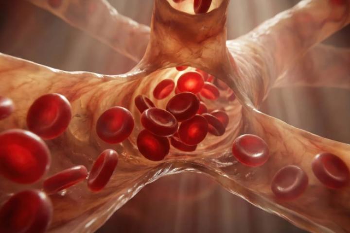 Aspirin and clopidogrel