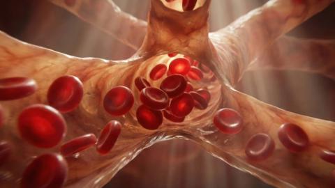 Aspirin and clopidogrel